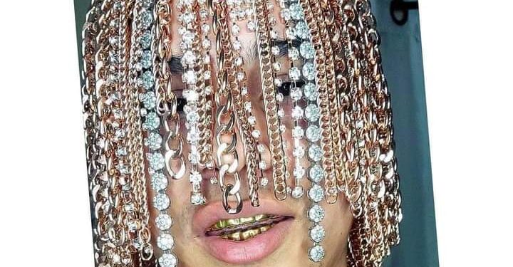 Rapper Implants Gold Chains Into His Head