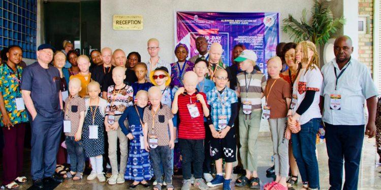 Albinism Association offer free medical services to members in Abuja